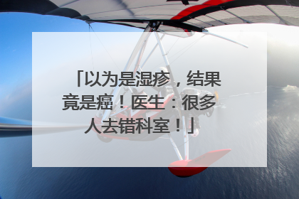 以为是湿疹，结果竟是癌！医生：很多人去错科室！